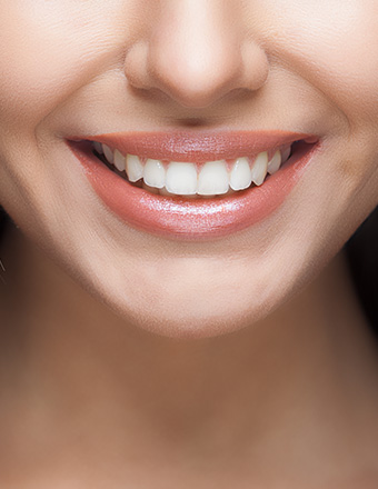 Tooth Whitening